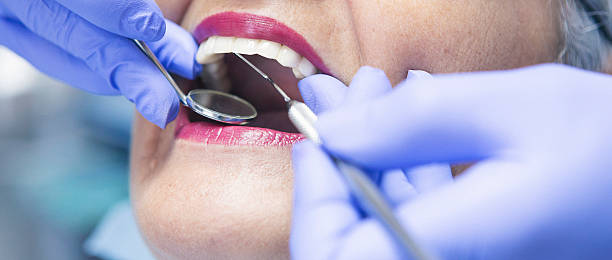 Best Knocked-Out Tooth (Avulsed Tooth) Treatment in , ME